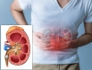 Sỏi thận gây những nguy hiểm gì? Khi nào cần mổ sỏi thận?